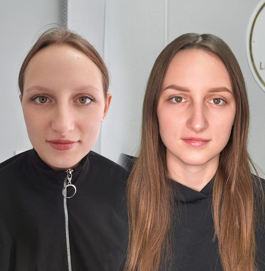 22